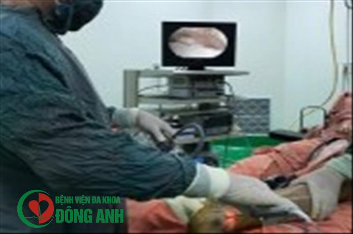Phẫu thuật nội soi khớp cổ chân tại bệnh viện đa khoa Đông Anh
