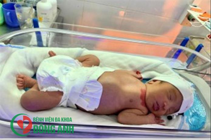CHĂM SÓC VÀ ĐIỀU TRỊ THÀNH CÔNG TRẺ SINH NON NHẸ CÂN