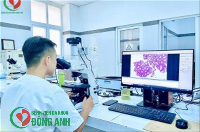 XÉT NGHIỆM GIẢI PHẪU BỆNH TẠI BỆNH VIÊN ĐA KHOA ĐÔNG ANH TIÊU CHUẨN VÀNG TRONG CHẨN ĐOÁN CÁC BỆNH LÝ UNG BƯỚU