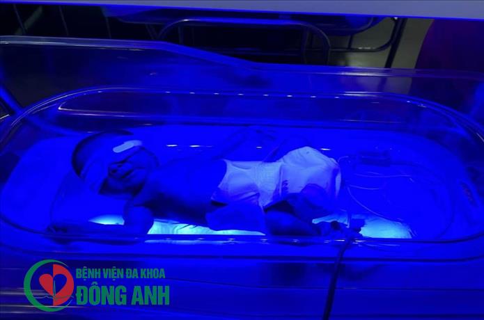 KHOA NHI - BỆNH VIỆN ĐA KHOA ĐÔNG ANH CHĂM SÓC VÀ ĐIỀU TRỊ THÀNH CÔNG TRẺ SINH NON NHẸ CÂN 33 TUẦN 5 NGÀY 1900 GRAM