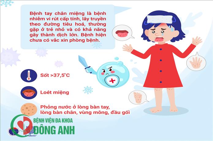 CẢNH GIÁC VỚI BỆNH TAY CHÂN MIỆNG Ở TRẺ EM