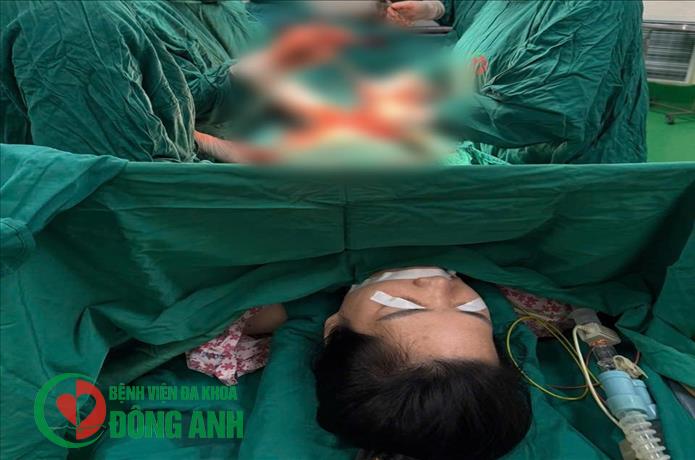 PHẪU THUẬT THÀNH CÔNG KHỐI U XƠ TỬ CUNG KÍCH THƯỚC LỚN, BẢO TỒN TỬ CUNG CHO NGƯỜI BỆNH